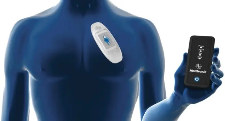 All about Mobile Cardiac Telemetry (MCT)